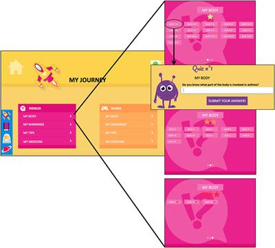 Fostering Health Education With a Serious Game in Children With Asthma: Pilot Studies for Assessing Learning Efficacy and Automatized Learning Personalization